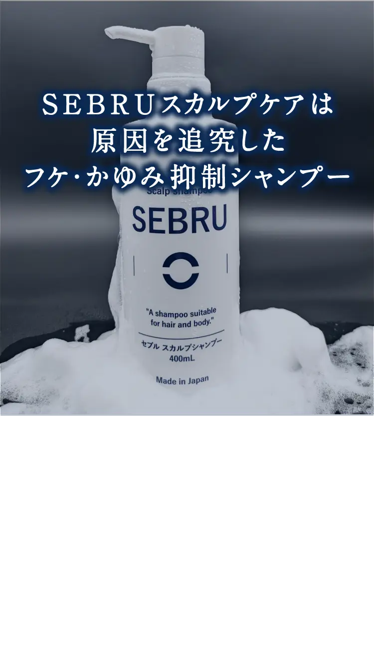 SEBRUスカルプケアは原因を追究したフケ・かゆみ抑制シャンプー